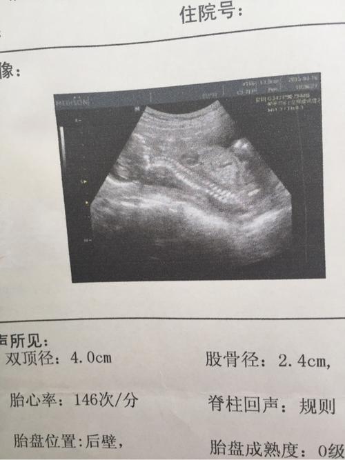 算命的能看出流产吗(算命为什么能看出流产几次-第1张图片-周易占卜网 - 免费算命_生辰八字算命_八字合婚姻