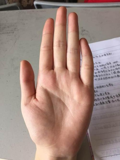 小孩手背黑算命(小孩手背变黑的原因)-第2张图片-周易占卜网 - 免费算命_生辰八字算命_八字合婚姻