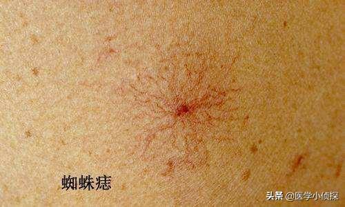 算命的说肝有点毛病是什么意思-第1张图片-周易占卜网 - 免费算命_生辰八字算命_八字合婚姻