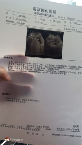 怀孕能算命出来吗(算命能看出来怀孕吗)-第1张图片-周易占卜网 - 免费算命_生辰八字算命_八字合婚姻